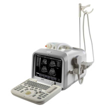 Sistema portátil de diagnóstico ultra-sônico Digital completo